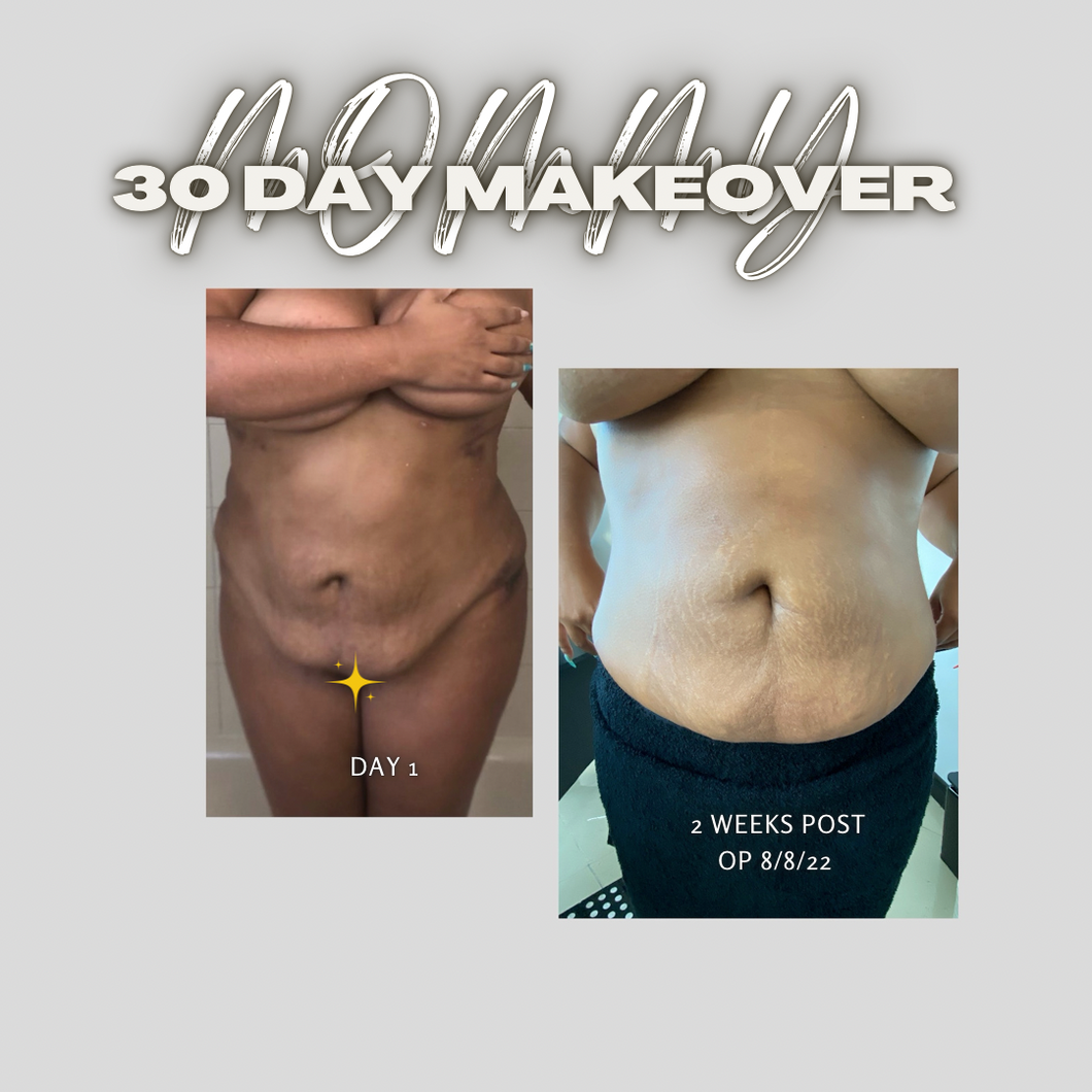 Mommy Makeover Packages